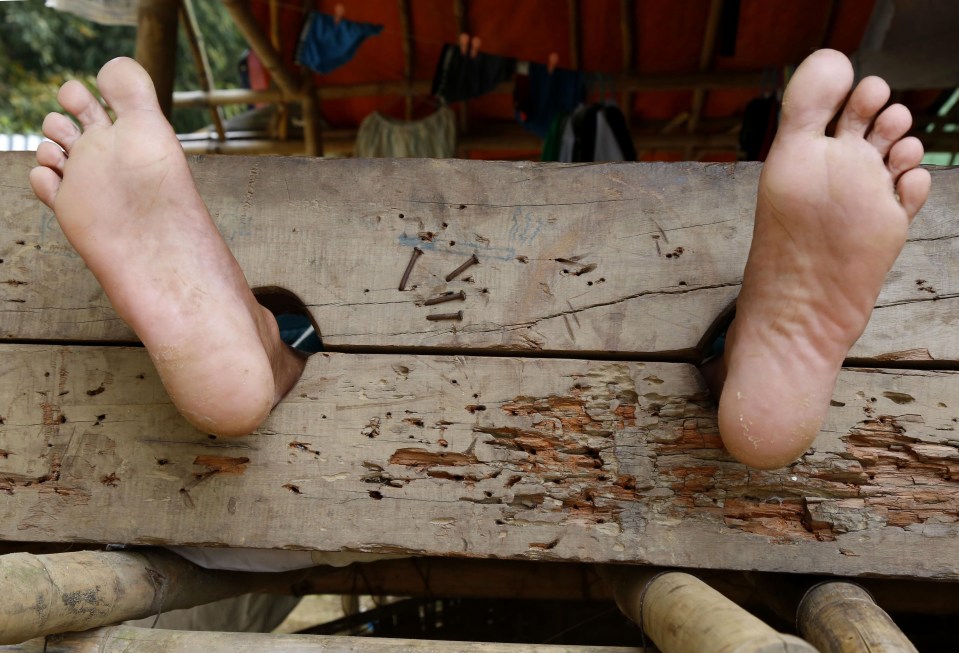 A drug addict's feet are restrained in a wooden device at a Myanmar rehabilitation center.