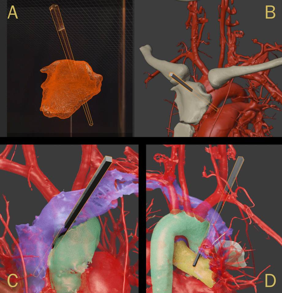 3D renderings showing arrow trajectory through a skull and heart.