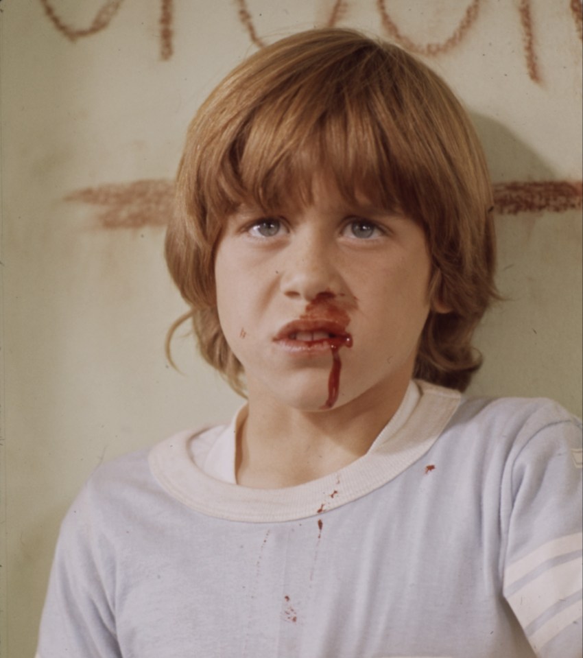 Young Christian Juttner with a bloody nose on the set of ABC Afterschool Specials.