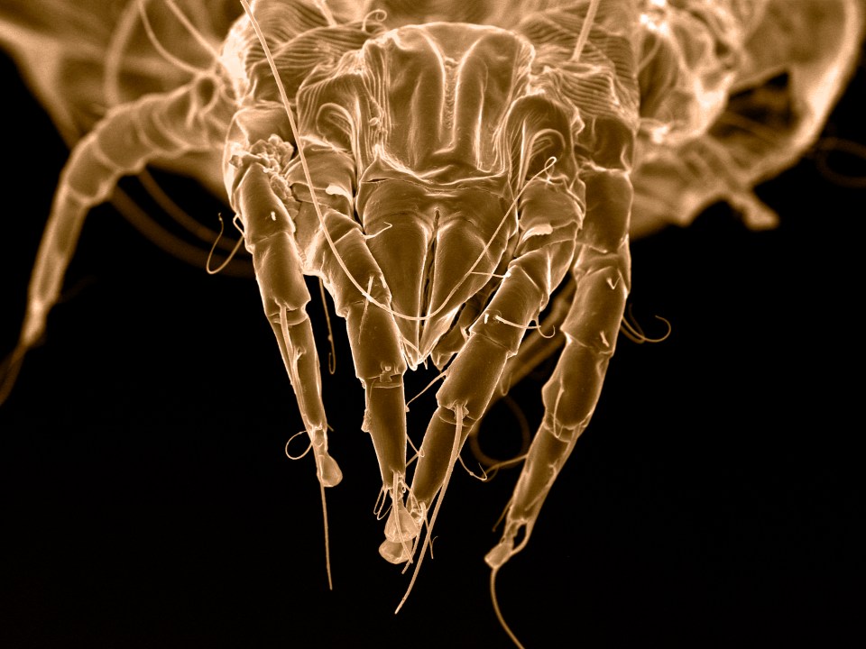 Microscopic image of a dust mite.