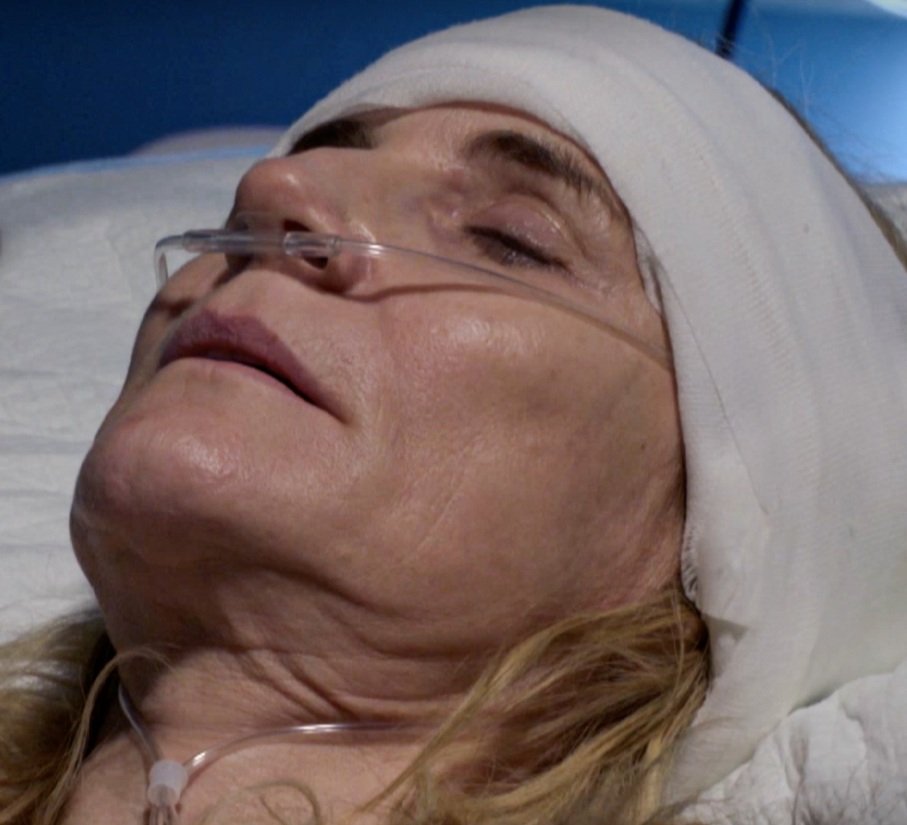 Close-up of a woman lying in a hospital bed with a head bandage and nasal cannula.