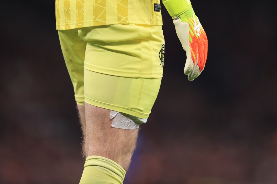 Close-up of a soccer goalkeeper's heavily bandaged right thigh.