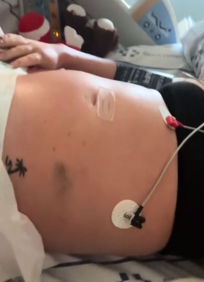 Woman in hospital bed with medical sensors attached to her abdomen.