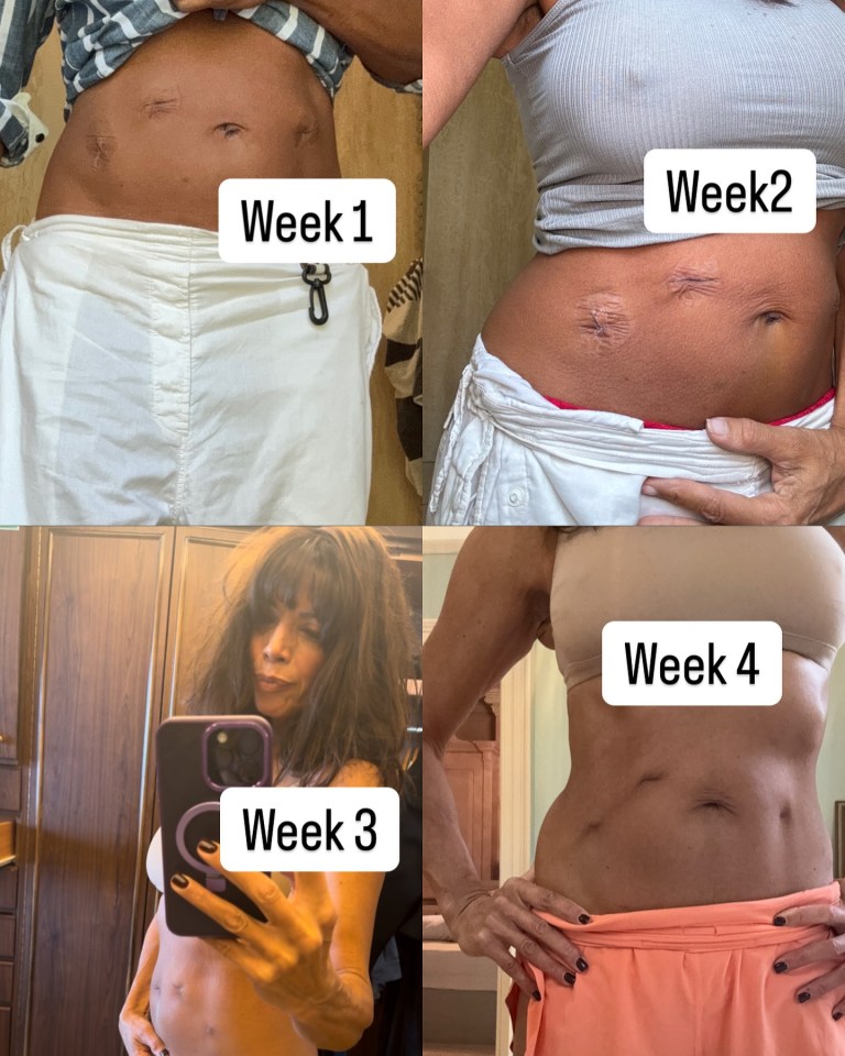 Jenny Powell has shared several pictures of her recovery following the hysterectomy