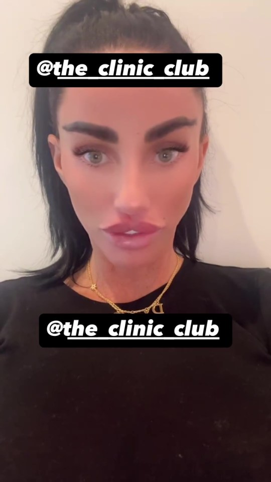 Katie Price showing off her new lips at The Clinic Club.