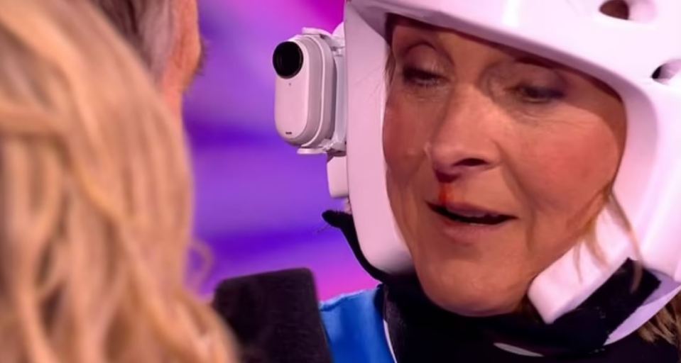 Louise Minchin with a bloody nose after a Gladiators challenge.