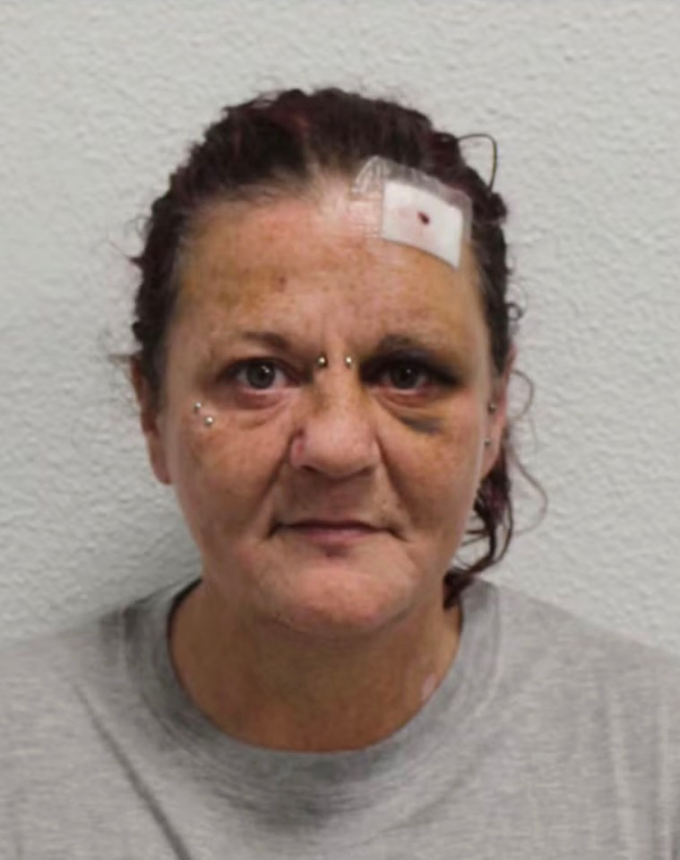 Mugshot of Gemma Watts, showing a bandage on her forehead and a bruise under her eye.