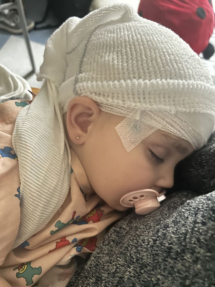 A baby girl sleeping in a hospital bed with bandages on her head.