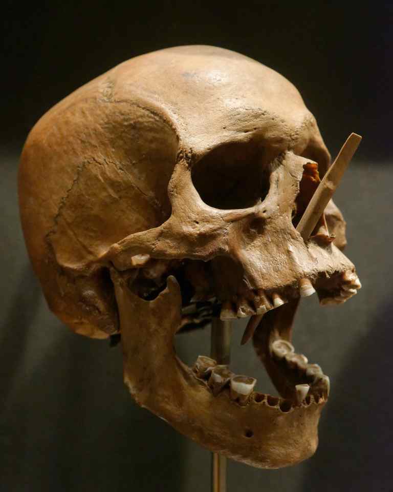 Skull of the Porsmose man with an arrow penetrating it.