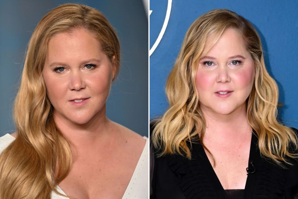 Amy Schumer in two different photos.