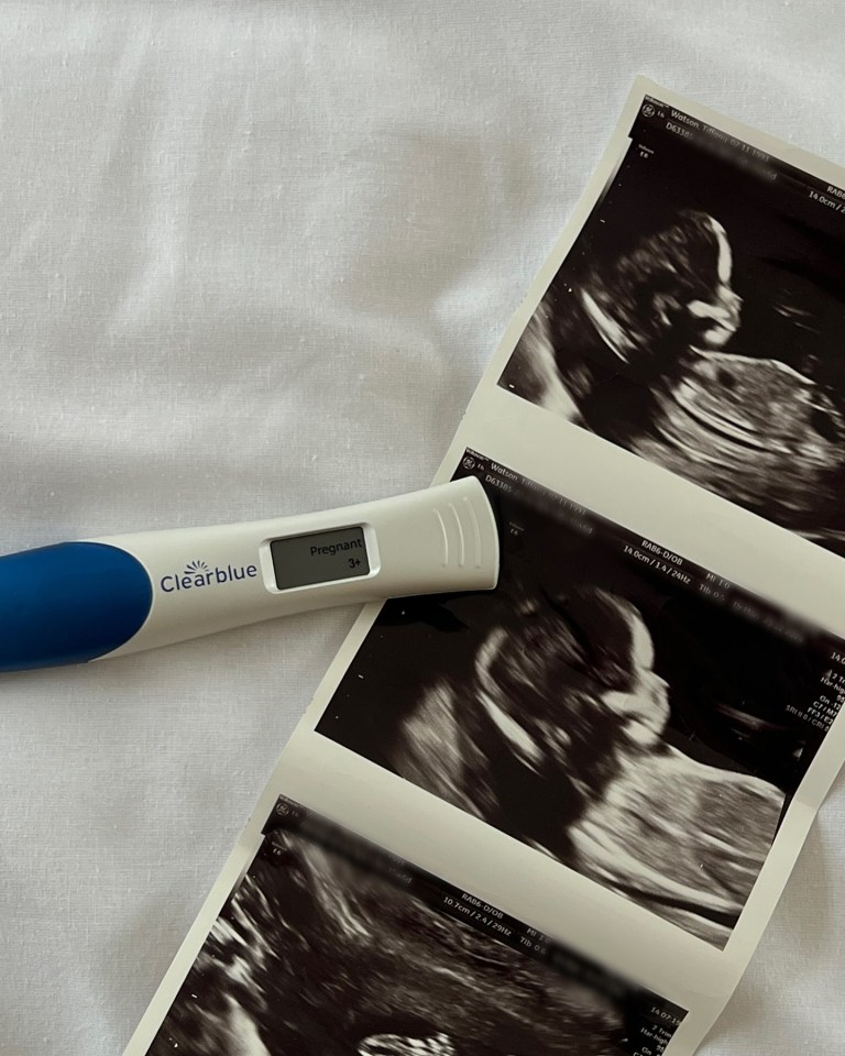 Positive pregnancy test and ultrasound images.