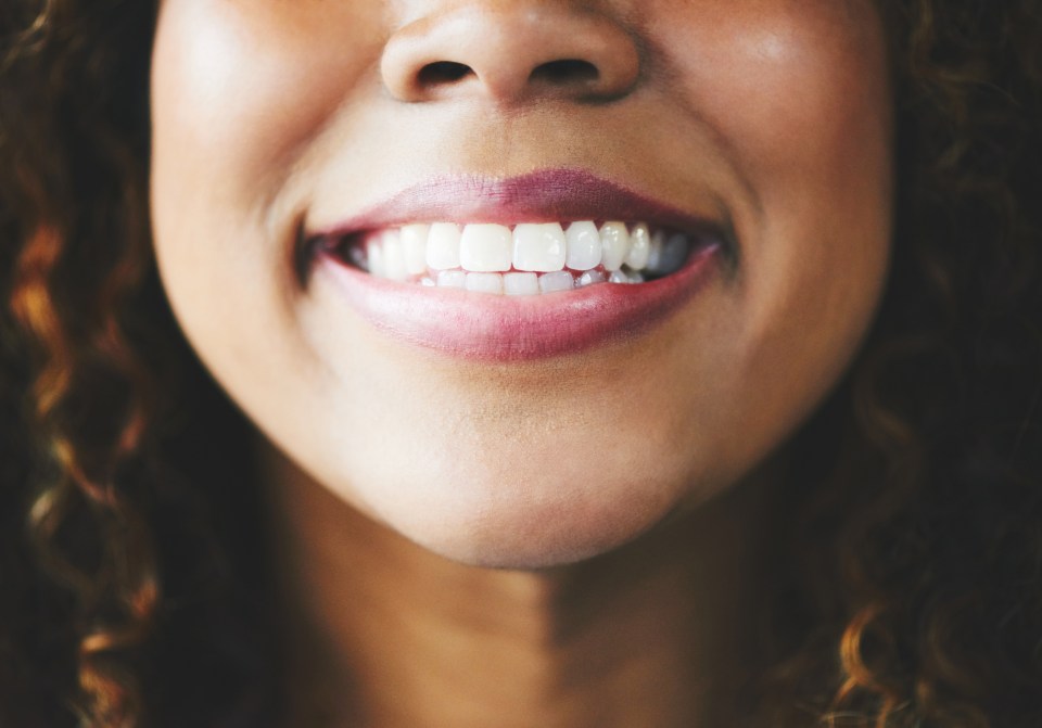 Close-up of a woman smiling, showing healthy teeth.