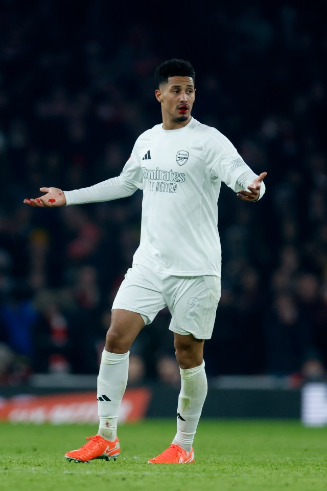 William Saliba of Arsenal with a bloody mouth and hand.