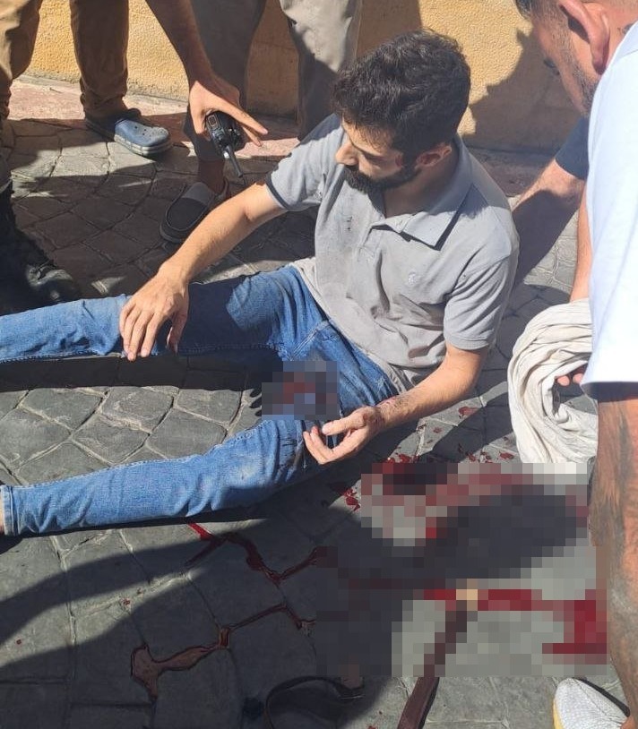 A man sits on the ground bleeding profusely from a leg injury.