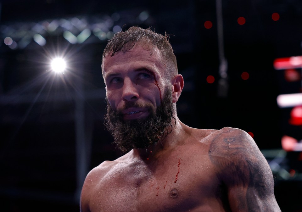 Anthony Cacace with blood on his face and chest after a boxing match.