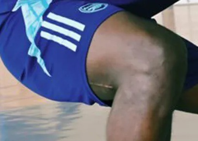 Soccer player doing resistance band exercises, close-up shows a scar on his arm.