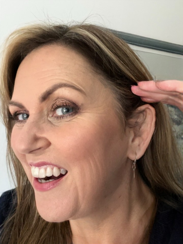 Woman smiling and touching her hair after ear filler treatment.