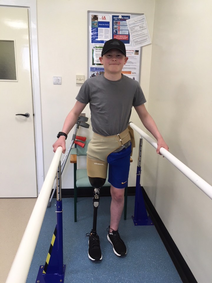 Teenage boy with prosthetic leg using parallel bars for physical therapy.