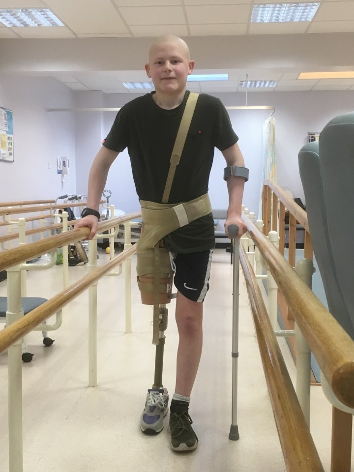 A young boy with a prosthetic leg uses parallel bars for physical therapy.