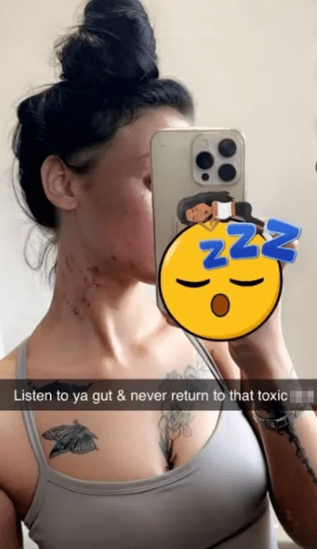 Person holding phone showing neck with marks, and chest tattoos.  Text overlay reads "Listen to ya gut & never return to that toxic".