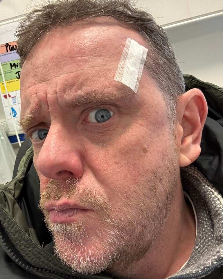 Close-up of Liam Fox with a bandage on his forehead.