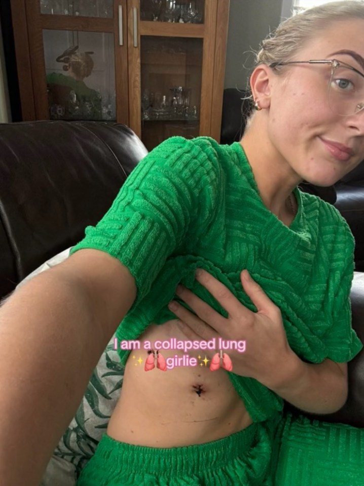 Woman showing her chest drain scar after multiple lung collapses.