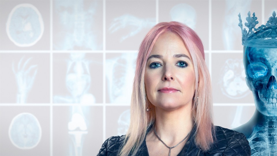 Professor Alice Roberts in front of x-rays and a crowned skull.