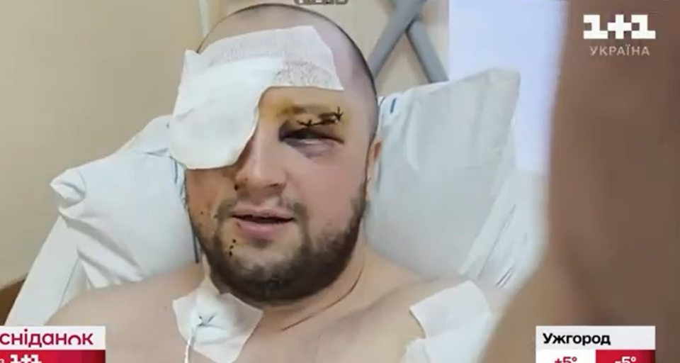 Injured Ukrainian cameraman Pavlo Borysko in a hospital bed.